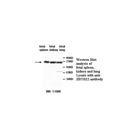 ZBTB6 Antibody