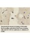 ZCCHC12 Antibody