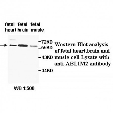 ABLIM2 Antibody