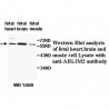 ABLIM2 Antibody