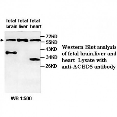 ACBD5 Antibody