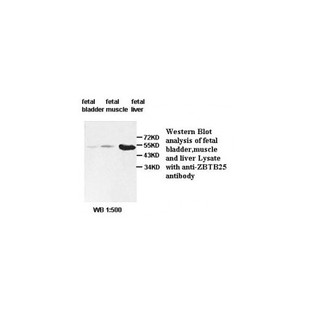 BCL2 Antibody