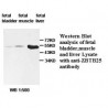 ZBTB25 Antibody