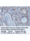 BCL2 Antibody