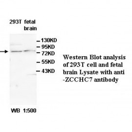 ZCCHC7 Antibody