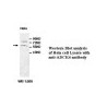 ADCK4 Antibody