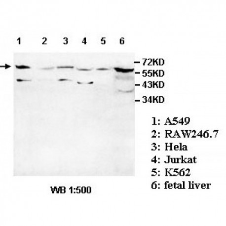 ADCK1 Antibody