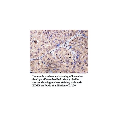 BCL2 Antibody