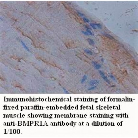 BMPR1A Antibody