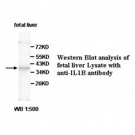 IL1B Antibody