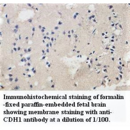 CDH1 Antibody