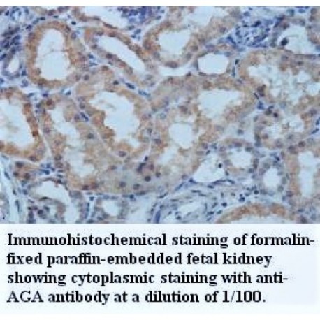 AGA Antibody