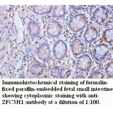 ZFC3H1 Antibody