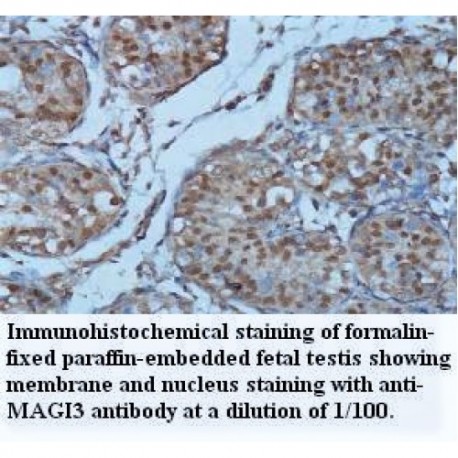 MAGI3 Antibody