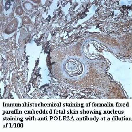 POLR2A Antibody