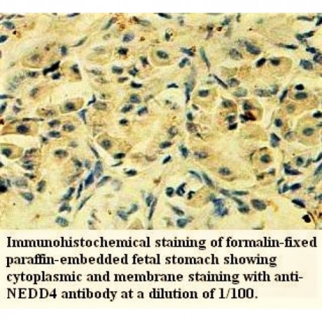 NEDD4 Antibody