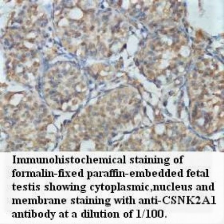 CSNK2A1 Antibody