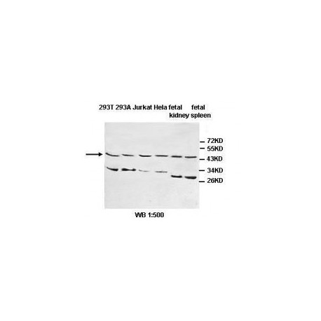 IL1R2 Antibody