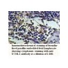 UCHL1 Antibody
