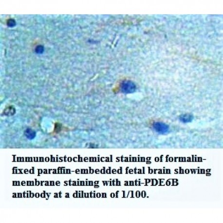 PDE6B Antibody