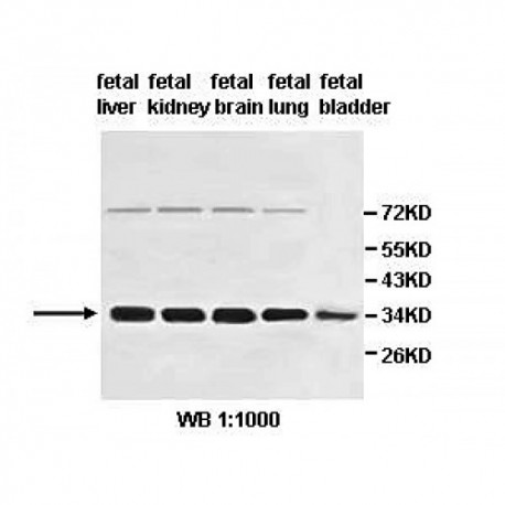 HSD17B13 Antibody