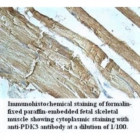 PDK3 Antibody