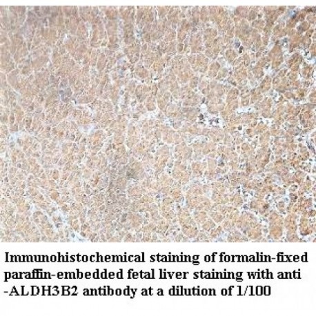 ALDH3B2 Antibody