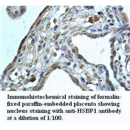 HSBP1 Antibody