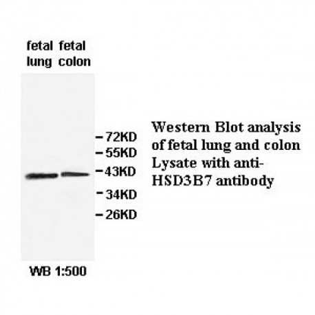 HSD3B7 Antibody