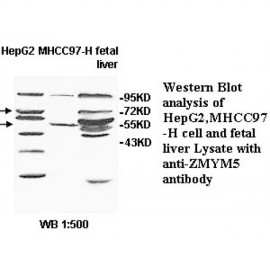 ZMYM5 Antibody