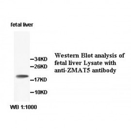 ZMAT5 Antibody
