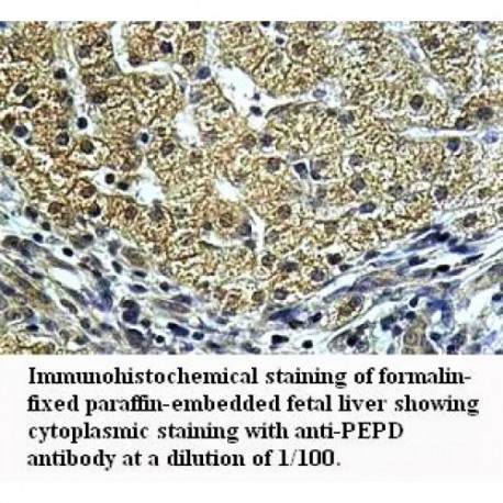 PEPD Antibody