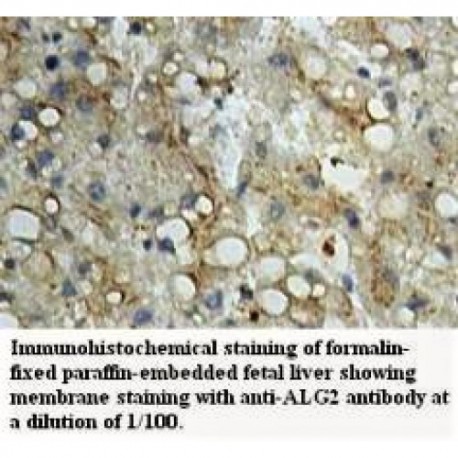 ALG2 Antibody