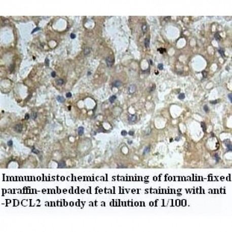 PDCL2 Antibody