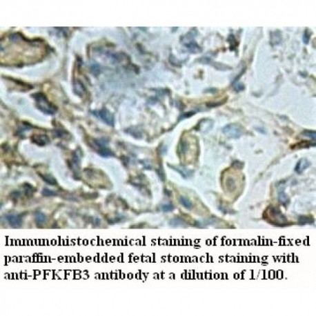 PFKFB3 Antibody