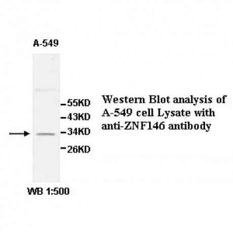 ZNF146 Antibody