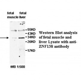 ZNF138 Antibody