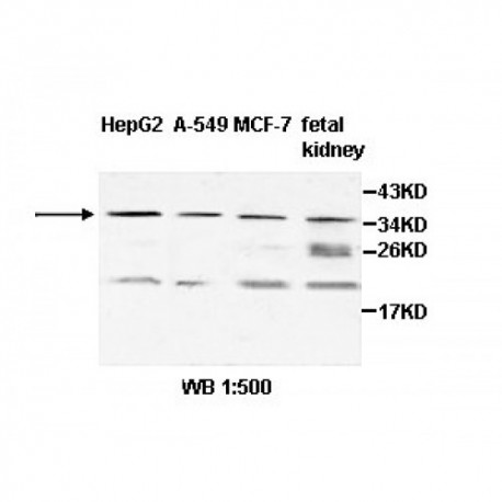 ZNF101 Antibody