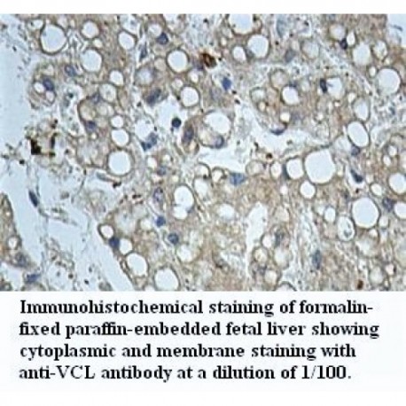 VCL Antibody