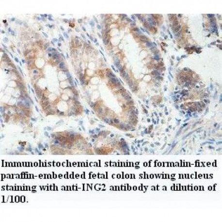 ING2 Antibody