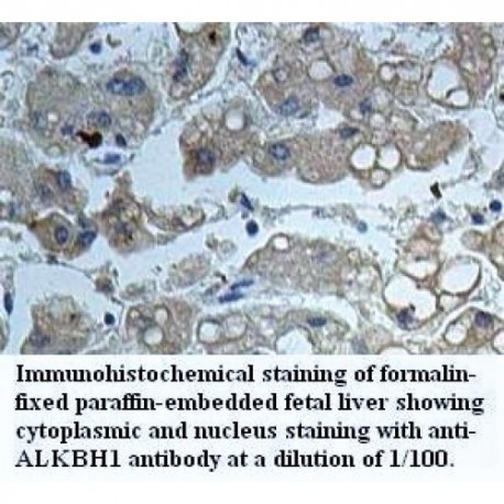 ALKBH1 Antibody