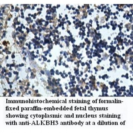 ALKBH3 Antibody