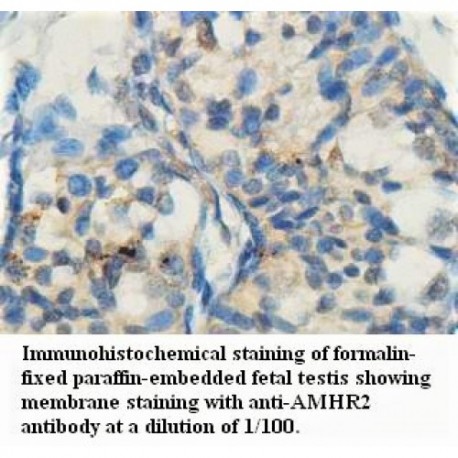 AMHR2 Antibody