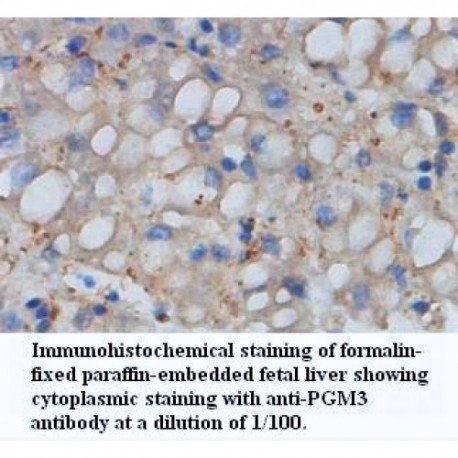 PGM3 Antibody