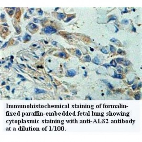 ALS2 Antibody