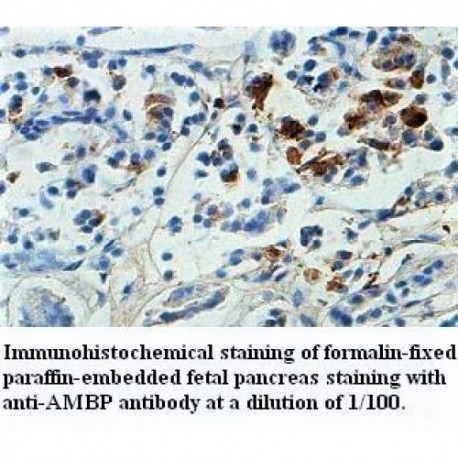 AMBP Antibody