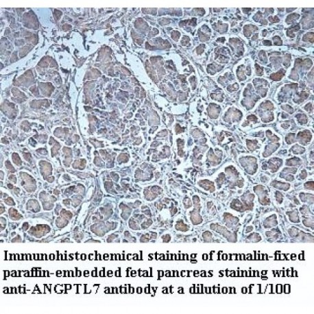 ANGPTL7 Antibody