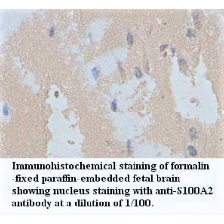 S100A2 Antibody