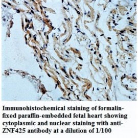 ANAPC2 Antibody
