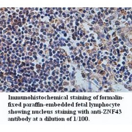 ANAPC2 Antibody